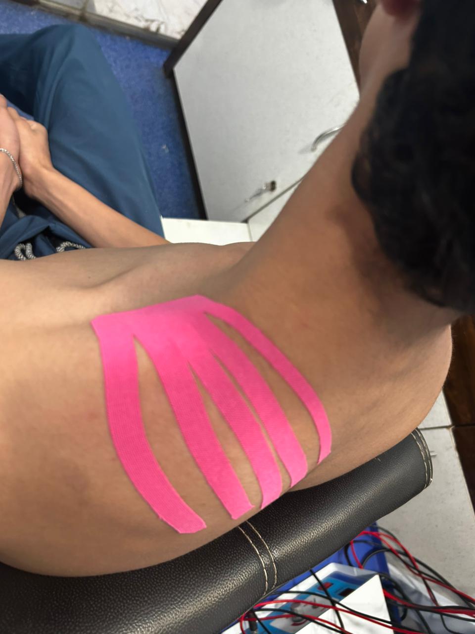 Kinesio taping therapy